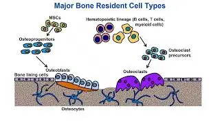 CASK bone biology