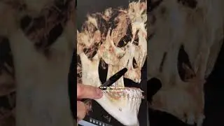 Что такое открытый синус-лифтинг? И как лучше установить импланты, если нет кости #shots