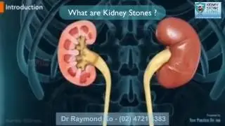 What are Kidney Stones?