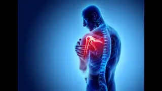 Shoulder problems | Symptoms | How does shoulder issues present and what can we do?.