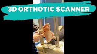 3D Orthotic Scanner