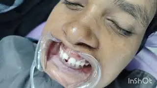 Oral Hygiene kit