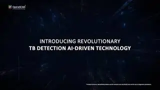 OptraSCAN's Revolutionary Technology for Microbial TB Detection