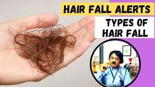 Hair fall Alerts | Type Of Hair Loss Pattern | Hair fall-You Should Know | HealthyMyself