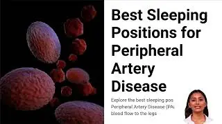 Best Sleeping Positions for Peripheral Artery Disease: Improve Leg Blood Circulation