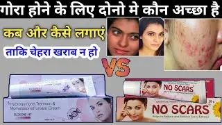 No scars Vs Elosone ht cream | elosone ht cream | no scars cream | चेहरा गोरा करने वाली क्रीम | apna