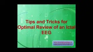 Tips and Tricks for Optimal Review of an Ictal EEG