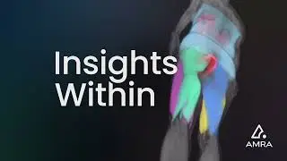 New Year, New Solutions: AMRA Medical Continues Commitment to Innovation & Data-Driven Excellence
