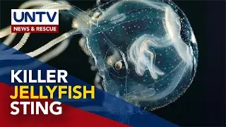 ALAMIN: Mga Dapat Gawin kapag Kinapitan ng Dikya o Jellyfish