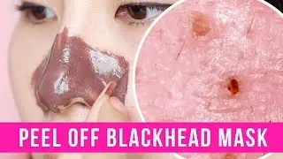 Peel Off Blackhead Mask Under a Microscope