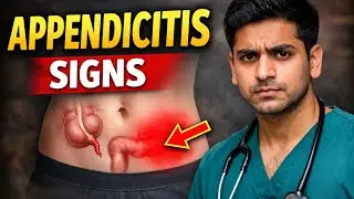 &ldquo;Abdominal pain? Don&rsquo;t miss these signs.#appendicitis #doctorexplains #surgery 