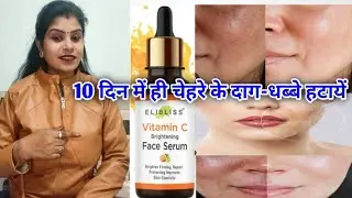 Elibliss Vitamin C Face Bright Serum Honest Reviews In Hindi (2026) |