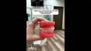 Interested in Clear Aligners??