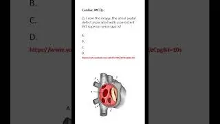 Medicine & Surgery MCQs (For MBBS, USMLE, MCCQE & PLAB)