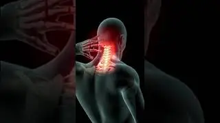Kidney Stone | Kidney Stone Treatment | Kidney Stones Symptoms | Kidney Stones Foods To Eat 5#shorts