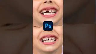Fix Missing Teeth in Photoshop | Clone Stamp Dental Repair #shorts #shortsvideo