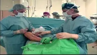 WE CBS 5P VEINS HEALTHWISE