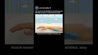 This Technology Tracks Breathing & Hand Movements To Detect Disease Early. Here's How #tech #shorts