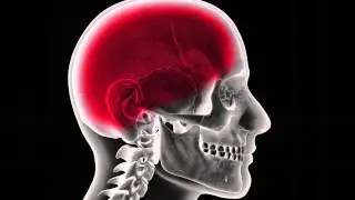 Ask The Expert - Meningitis - Dr Melissa Barton, Sinai-Grace Emergency Physician