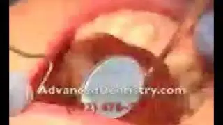 Advanced Dentistry Company Reviews | www.AdvancedDentistry.com
