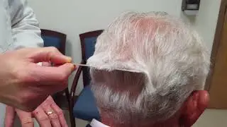 Hair Transplant Donor Sites