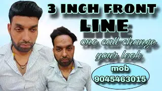 Buy front line Hair patch| front hairline Loss| parmanent hair patch| mob 9045463015