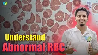 Abnormal RBCs at a Glance | Easiest Explanation for MLT & Paramedical Students 