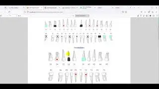 Odontograma para o Sistema Odontológico - Aprenda a Desenvolver