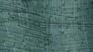 static wire
