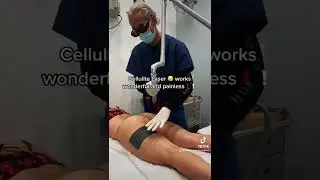 Cellulite Laser 😧 painless !