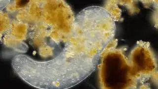 Pelomyxa palustris