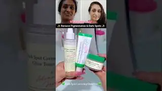Remove Pigmentation, Dark Spots ✨ Skin whitening, Face Glow Toner Serum & Cream ✨ #skincare #shorts