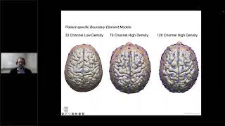 Benjamin Brinkman, Ph.D - EEG Source Localization: Technical Considerations, Intracranial Monitoring