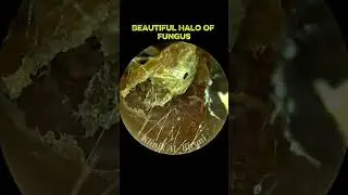 Beautiful Halo Of Fungus