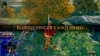 BigBeardeds' Bloody Finger #3