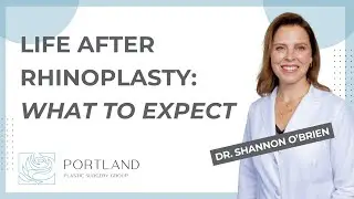 Life After Rhinoplasty: What to Expect