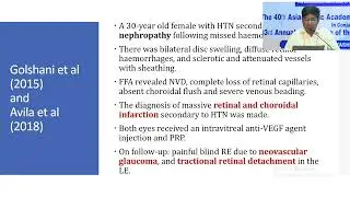 AIOS2025 GP89 T Dr Prateek NISHANT A New Outlook on Hypertensive Retinopathy