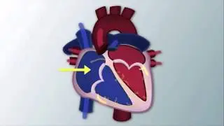 Non-Invasive Cardiovascular Monitoring by B. Johnson | OPENPediatrics