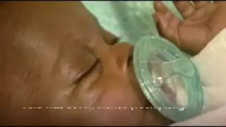 Smallest premature baby Aaliyah Hart now a teenager