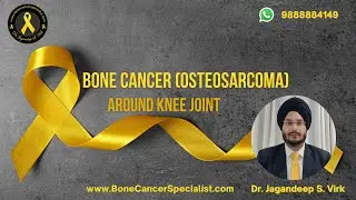 Osteosarcoma (Bone Cancer) Survivors Stories | Sarcoma Awareness Month