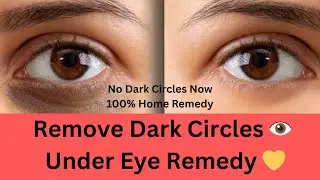 Remove Dark Circles Fast | Potato & Eye Serum | 100% Natural Remedy #viral #skincare #youtubeshorts 