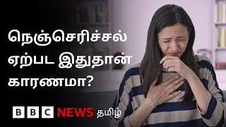 எந்தெந்த உணவு நெஞ்செரிச்சலை ஏற்படுத்தும்? தவிர்ப்பது எப்படி?