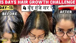 Ganje Ser ka Medicine💊Day-15 Of 15 Days Hair Growth Challenge👍2 Steps Only#haircare#viralvideo#diy