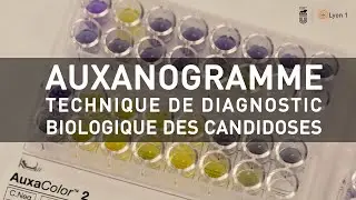 Auxanogramme, technique de diagnostic biologique des candidoses