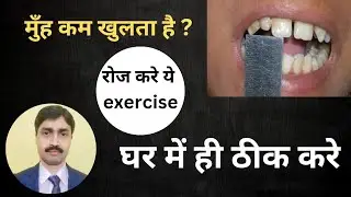 Effective Exercises for OSMF (Reduced Mouth Opening) | मुंह कम खुलना क्या है इलाज |