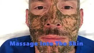2B Bio Peel Is An Alternative To Microneedling
