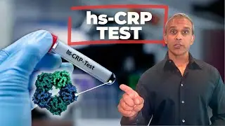 Heart Disease Prevention Starts With This Test
