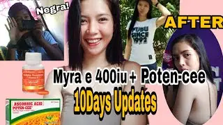 PAMPA Blooming✨ !! MYRA-E + POTEN CEE || Best & Affordable Supplements  🇵🇭