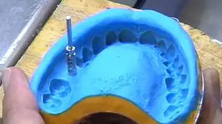 1. Preparation of the dental cast