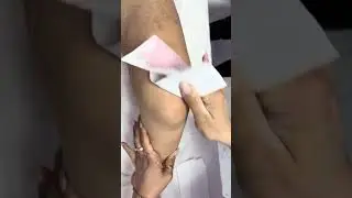 #wax #brazilianwax #waxing #depila&ccedil;&atilde;o #asmr  #hotwaxing #waxremoval #depilaci&oacute;n #depilacao #waxmelts
